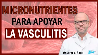 VASCULITIS🔴 Síntomas, Causas y Tratamiento (Dr. Jorge Ángel)