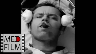 Electroshock in the treatment of schizophrenia ©  from "One Flew Over the Cuckoo's Nest"