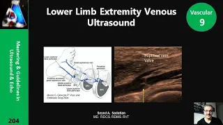 Lower Limb Extremity Venous Ultrasound