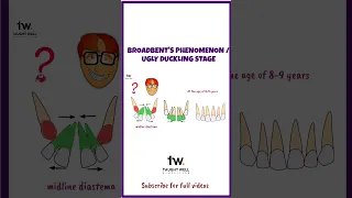 Broadbent's Phenomenon/ Ugly duckling 🦢 stage