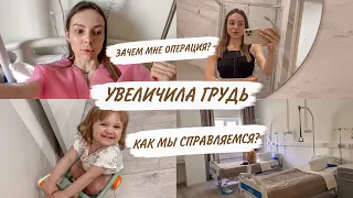 УВЕЛИЧЕНИЕ ГРУДИ😳МАММОПЛАСТИКА С ПОДТЯЖСКОЙ😨МОЙ ОПЫТ | ВОССТАНОВЛЕНИЕ | ОДНА С КИРОЙ