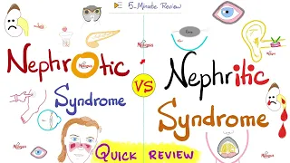 Nephrotic AND Nephritic Syndrome | Quick Review | Nephrology & Pathology