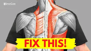 How to Fix Muscle Pain Between Your Shoulder Blades for Good
