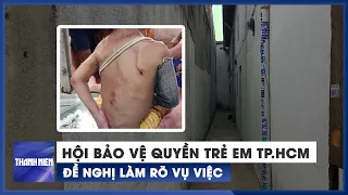 Sớm làm rõ vụ bé trai nghi bị bạo hành ở Hóc Môn