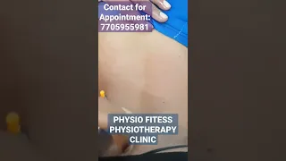 #physiotherapy #cuppingtherapy