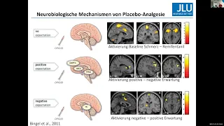 Placebo - Die Macht von Erwartungen und Implikationen für die Praxis