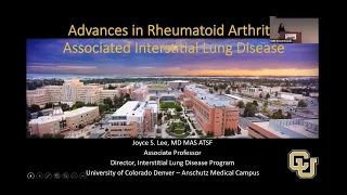 Advances in Rheumatoid Arthritis associated Interstitial Lung Disease