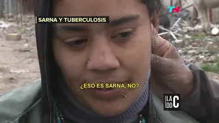 SARNA Y TUBERCULOSIS EN LOMAS DE ZAMORA | Lado C