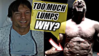 Should Devon Larratt Stop Arm wrestling | What Happened To Devon larratt