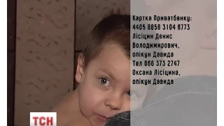 Трирічний малюк врятувався від пожежі та потребує допомоги