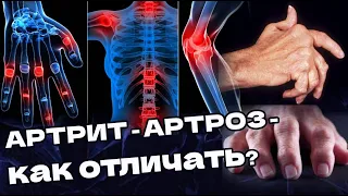 АРТРИТ - АРТРОЗ - названия похожи, Оба про болезни суставов! Как различить?