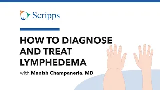 How to Diagnose and Treat Lymphedema with Manish Champaneria, MD | San Diego Health