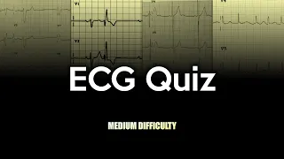 ECG Quiz: Medium Difficulty