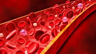 Anticoagulation for Venous Thromboembolic Disease - Presentation