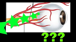 What is a Central Retinal Artery Occlusion?