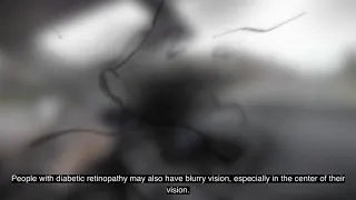 (Audio Described) See What I See: Diabetic Retinopathy Virtual Reality Experience