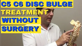 C5 C6 Disc Bulge Treatment Without Surgery | Bulging Disc C5 C6 |  Dr. Walter Salubro