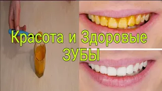 5 СПОСОБОВ Отбеливание зубов в домашних условиях/ Удаление зубного камня/Отбеливание и лечение зубов