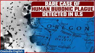 U.S: Rare case of Bubonic plague, that killed 50 million in 14th Century, detected | Oneindia News