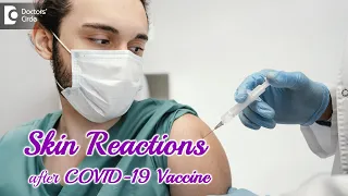 SKIN REACTIONS AFTER COVID-19 VACCINATION - Best tips to manage it-Dr. Rasya Dixit | Doctors' Circle