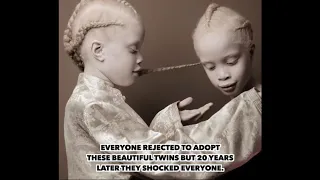 Everyone Rejected To Adopt These Beautiful Twins But 20 Years Later They Shocked Everyone