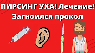 ПИРСИНГ УХА! Загноился прокол!  Лечение!