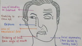 NERVE SUPPLY OF FACE ( Clinical Anatomy )