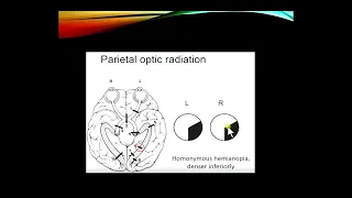 The Neurologic Examination, part 2