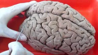 Surcos y circunvoluciones cerebrales