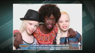 Conheça a história das gêmeas albinas que são filhas de pais negros e sonham em ser modelos