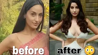 Nora fatehi before plastic surgery 😱 and other 20 secrets about Nora | Secrets of bollywood| #like