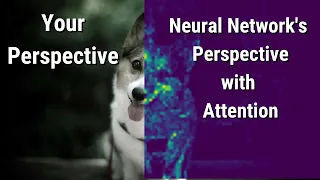 The power of "Attention" in Deep Learning