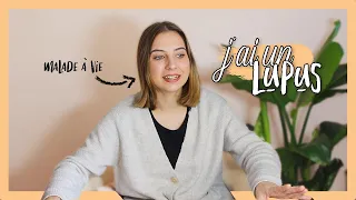 🤧 | J'AI UN LUPUS | MALADIE AUTO-IMMUNE