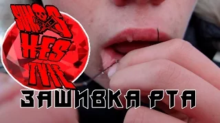 Зашивка рта~~|sumashestvie|~~