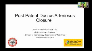 Post Patent Ductus Arteriosus Closure