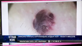 Онкологиялық аурулардың алдын алу - өзекті мәселе