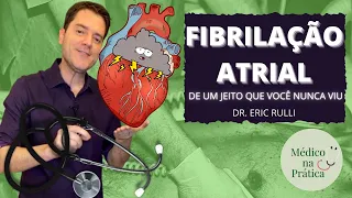 FIBRILAÇÃO ATRIAL DE UM JEITO QUE VOCÊ NUNCA VIU!