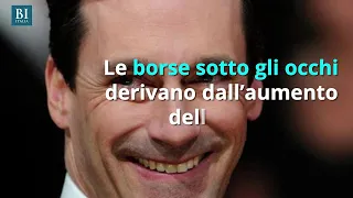 Cosa mangiare e come dormire per evitare le borse sotto gli occhi | Insider Italiano