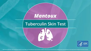 Mantoux Tuberculin Skin Test Video