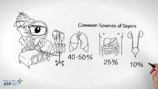 Managing Sepsis in the ICU