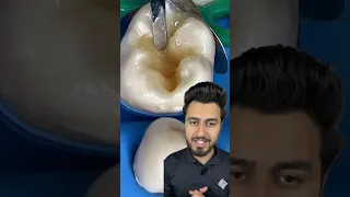 Type of tooth pain and their solution in dentistry | #views #shorts #short #shortvideo #subscribe