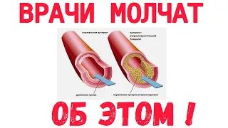 Ешьте   ЭТИ  5  простых  ПРОДУКТОВ  и  СОСУДЫ  ОЧИСТЯТСЯ  САМИ  !!!