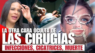 REVELAN LA PEOR Y LA MEJOR CARA DE LAS CIRUGÍAS PLASTICAS