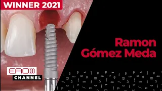 Immediate implant loading & simultaneous hard and soft tissues reconstruction w/ Ramon Gómez Meda