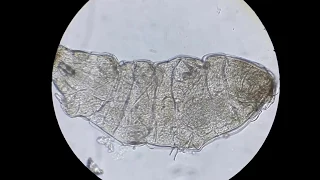 Тихоходка (Tardigrada).