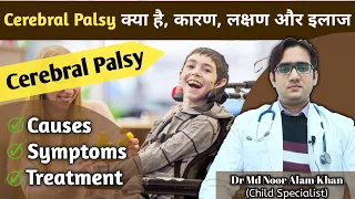 What is Cerebral Palsy | Causes, Symptoms, Complications and treatment | in Hindi | Dr Md Noor Alam