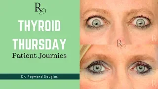 Patient Story - Customized Orbital Decompression | Dr. Raymond Douglas