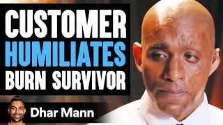 Customer Humiliates Burn Survivor, Then Instantly Regrets His Decision | Dhar Mann