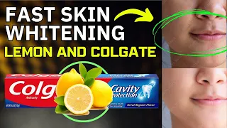 Fast Skin Whitening at Home! Lemon and colgate