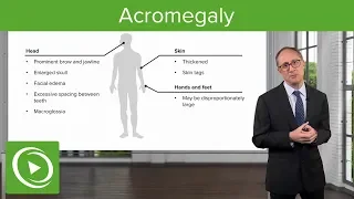 Acromegaly – Endocrinology | Lecturio